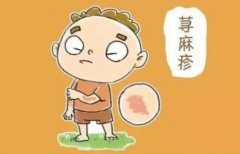 西宁市哪个医院治荨麻疹好